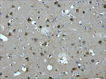 MAP2 Mouse Monoclonal Antibody