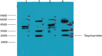 ERCC1 Mouse Monoclonal Antibody