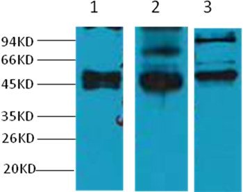 CK17 Mouse Monoclonal Antibody