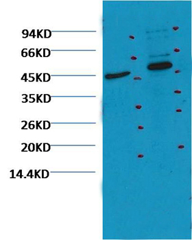 CD16 Mouse Monoclonal Antibody (Q32)