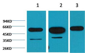 β-tubulin Mouse Monoclonal Antibody