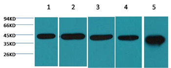 β-actin Mouse Monoclonal Antibody