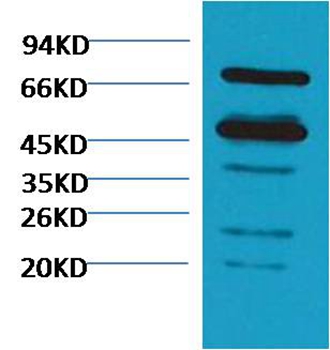 Rubisco Mouse Polyclonal Antibody(Large Chain)