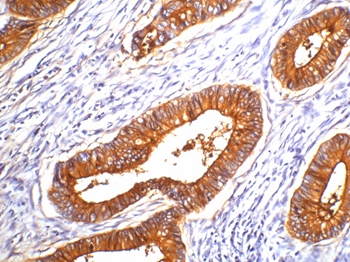 Carcinoembryonic Antigen Antibody