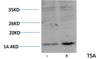 Histone H3(Acetyl-Lys27) Rabbit Polyclonal Antibody