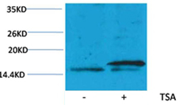 Histone H3(Acetyl-Lys36) Rabbit Polyclonal Antibody