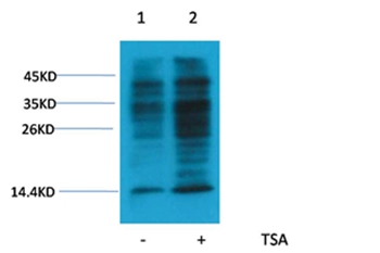 Acetyl-Lysine Rabbit Polyclonal Antibody