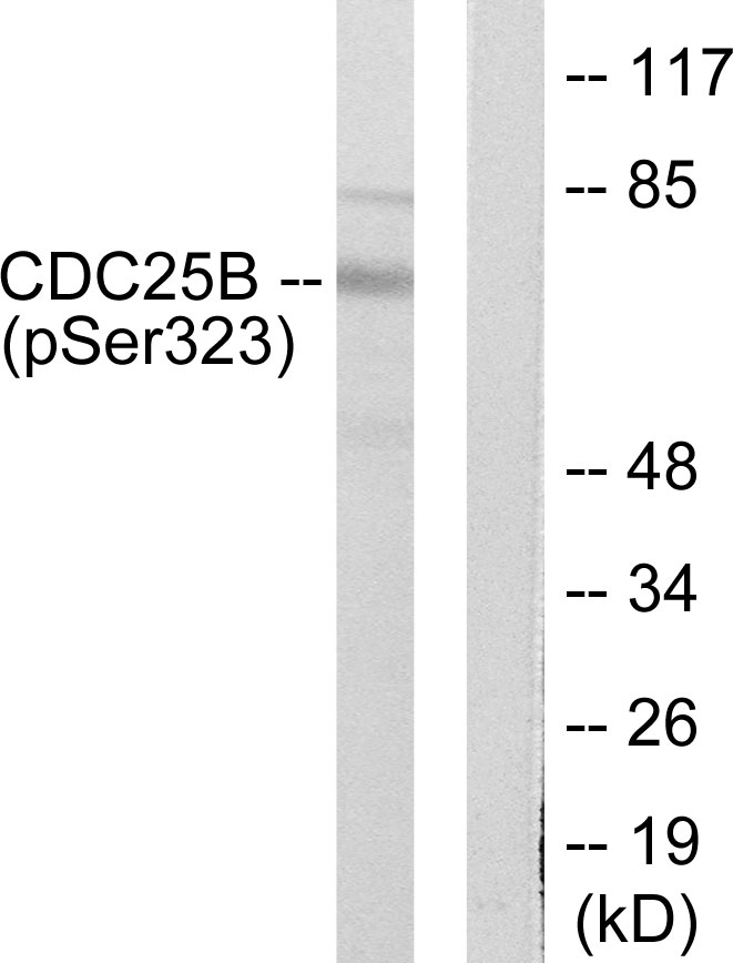 CDC25B (Phospho-Ser323) Antibody 
