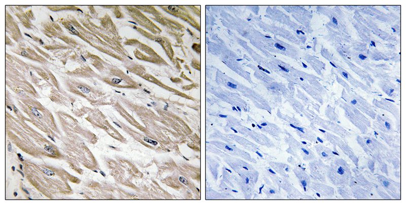PPP1R2 (Phospho-Ser120/Ser121) Antibody