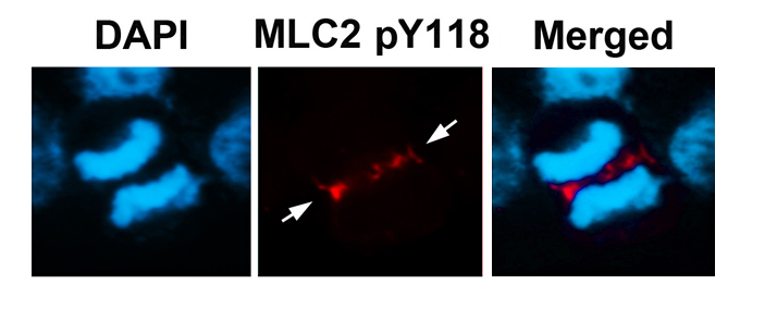 MLC2 (Phospho-Tyr118) Antibody