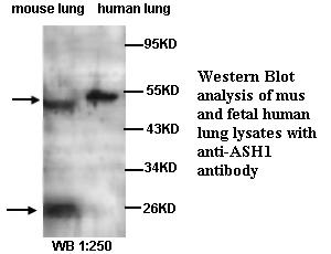 ASH1 Antibody