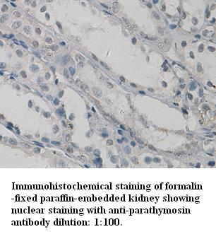parathymosin Antibody