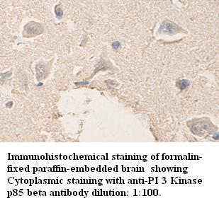 PI 3 Kinase p85 beta Antibody