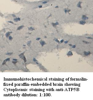 ATP6B Antibody