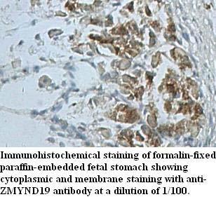 ZMYND19 Antibody