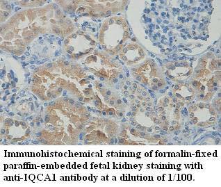 IQCA1 Antibody