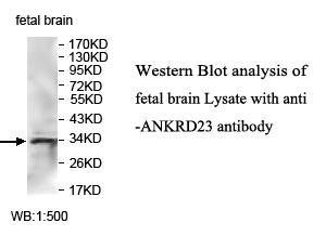ANKRD23 Antibody