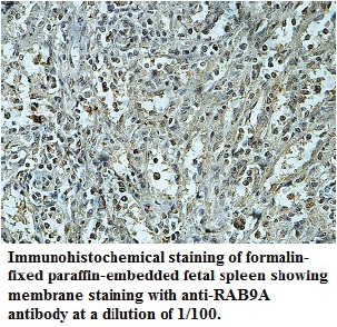 RAB9A Antibody