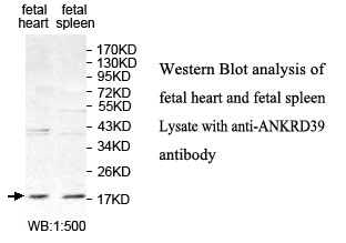 ANKRD39 Antibody