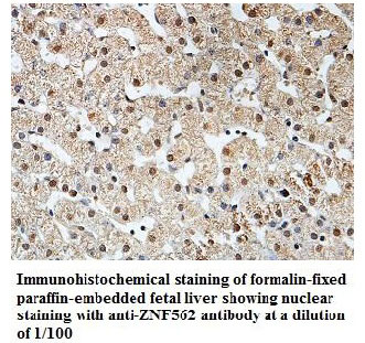 ZNF562 Antibody