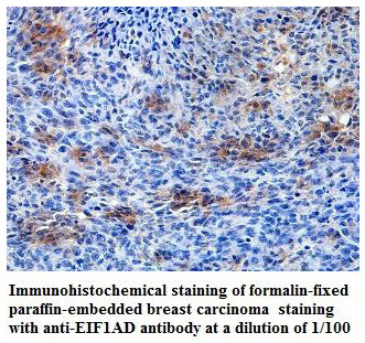 EIF1AD Antibody