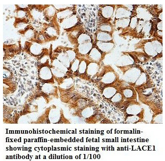 LACE1 Antibody