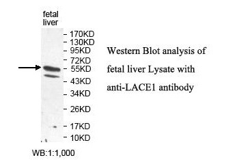 LACE1 Antibody