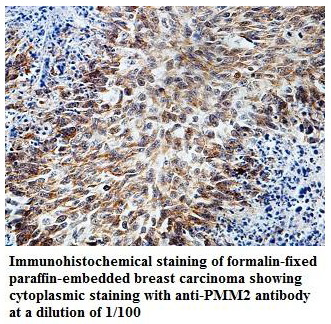 PMM2 Antibody