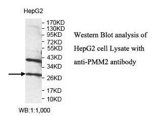PMM2 Antibody