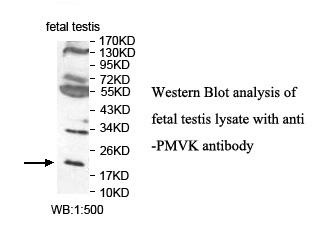 PMVK Antibody