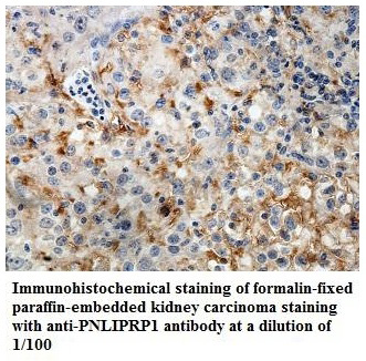 PNLIPRP1 Antibody