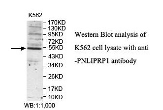 PNLIPRP1 Antibody
