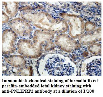 PNLIPRP2 Antibody