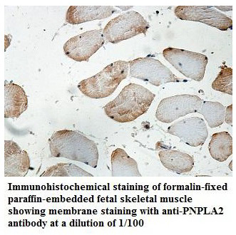 PNPLA2 Antibody