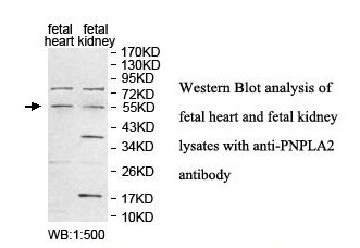 PNPLA2 Antibody