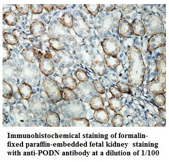 PODN Antibody