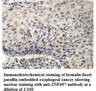 ZNF697 Antibody
