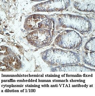 VTA1 Antibody