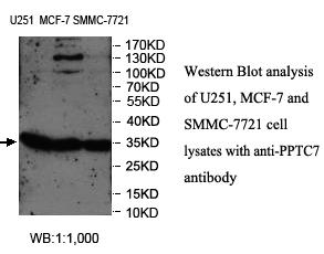 PPTC7 Antibody