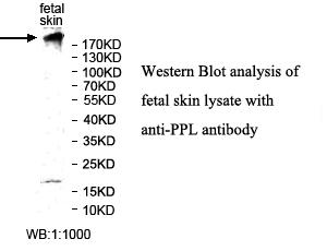 PPL Antibody