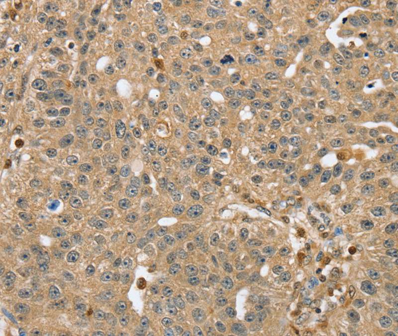 RNH1 Antibody