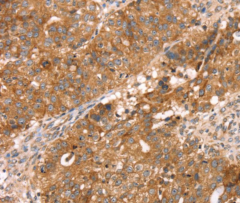 PDLIM4 Antibody