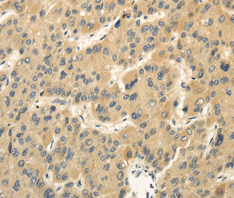 MED16 Antibody