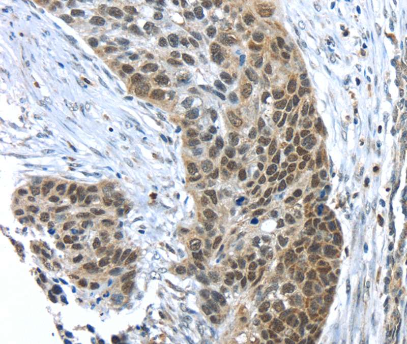 TKTL1 Antibody