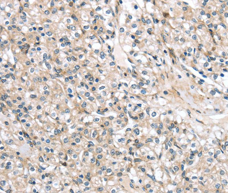 TMPRSS11B Antibody