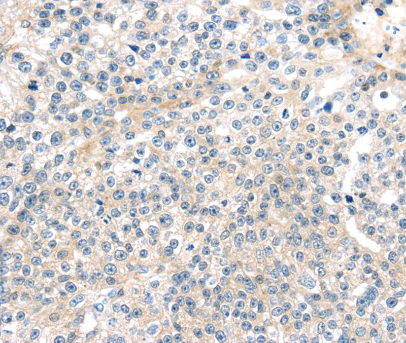 TNFAIP8 Antibody