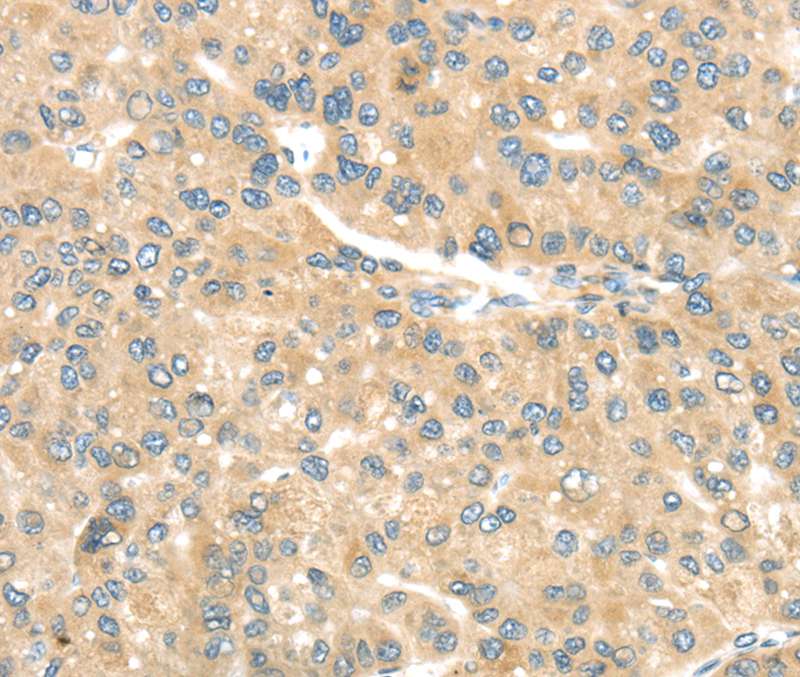 TRAK1 Antibody