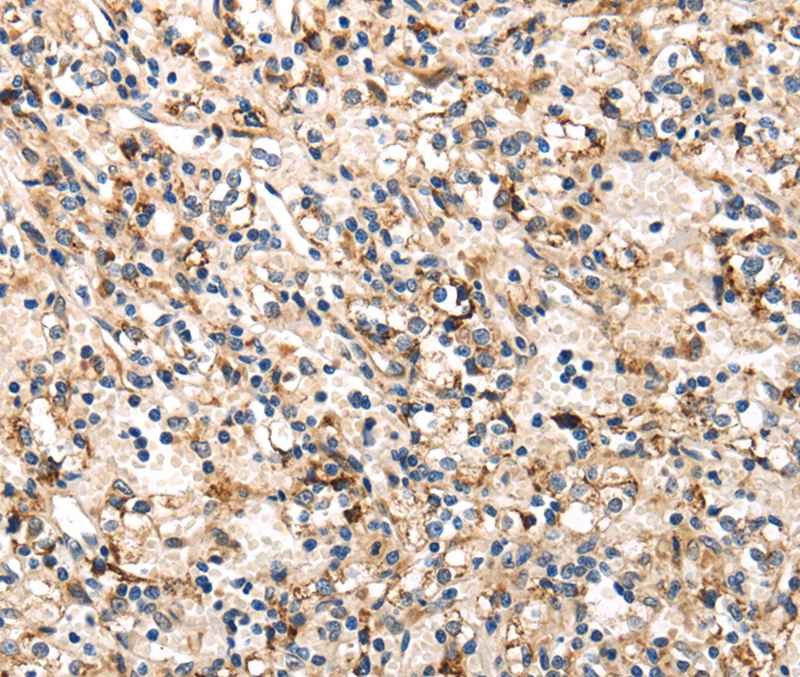 TRIB3 Antibody
