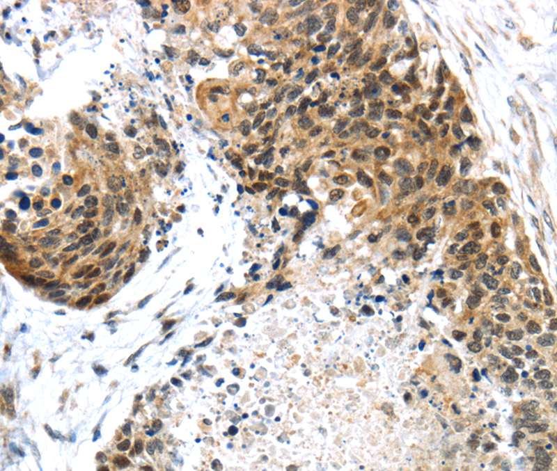 TRIM74 Antibody