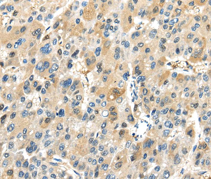 TRAIP Antibody